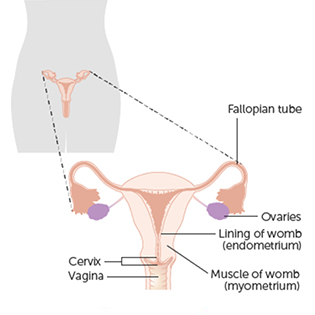 Endometrial Cancer