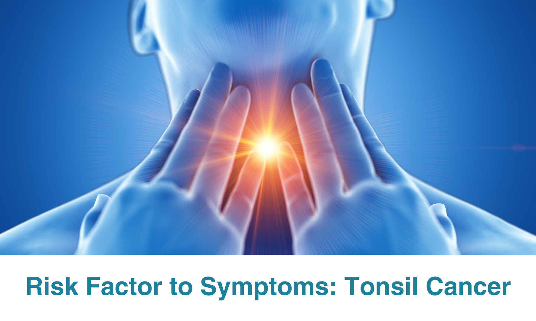 From Risk Factors to Symptoms: A Comprehensive Guide to Tonsil Cancer ...