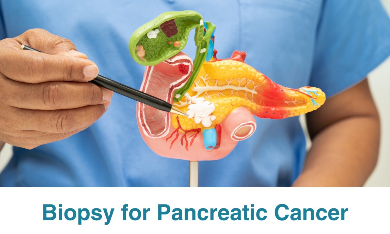 How is Pancreatic Cancer Detected? - Proton Therapy