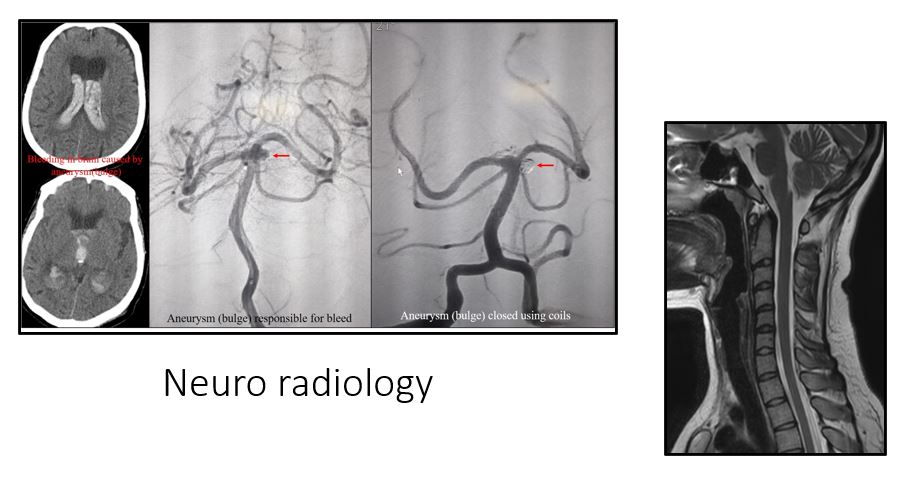 Neuro-radiology