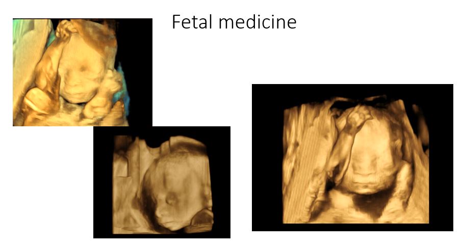 Fetal medicine