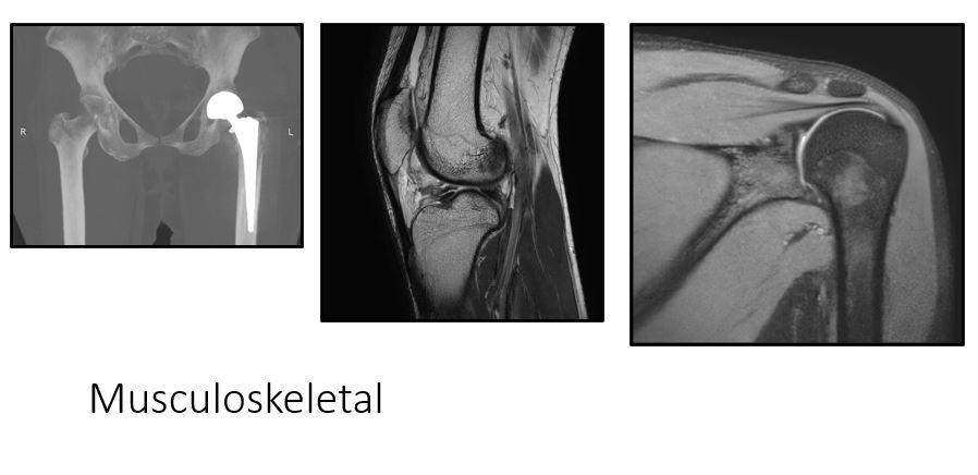 Musculoskeletal department