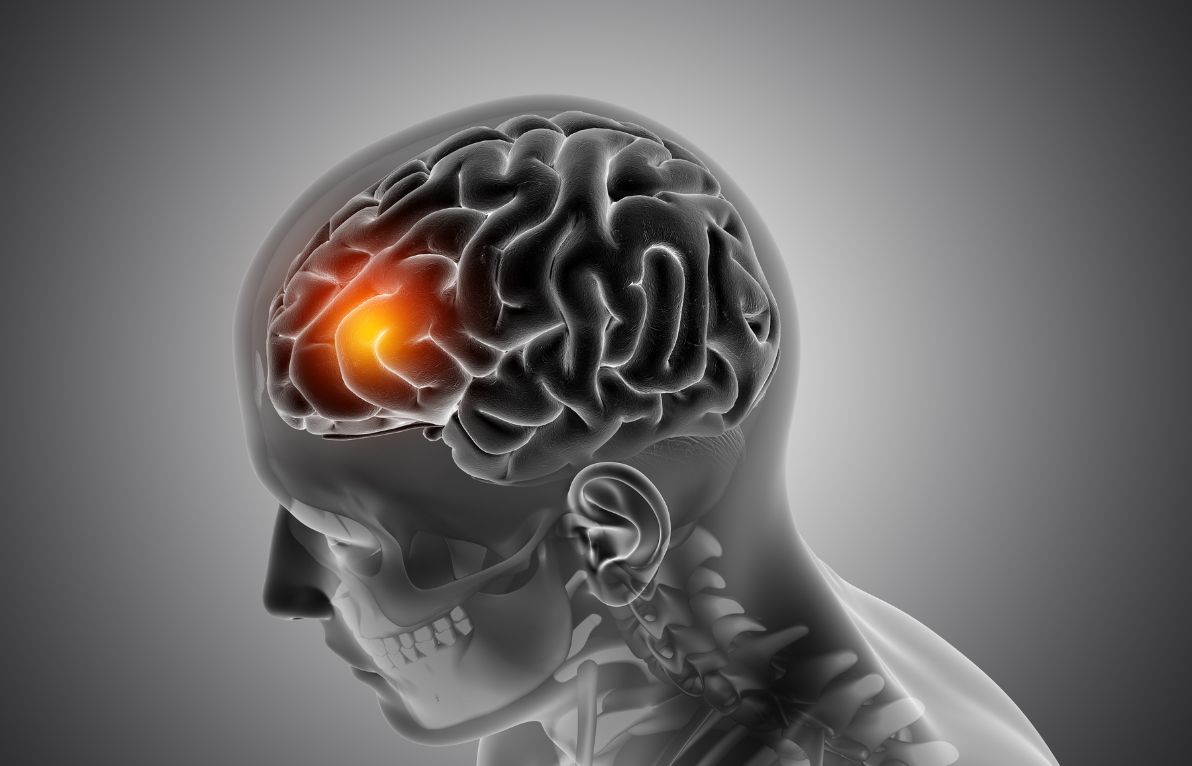 Understanding Skull Base Tumours: Types, Symptoms, and Diagnostic Approaches