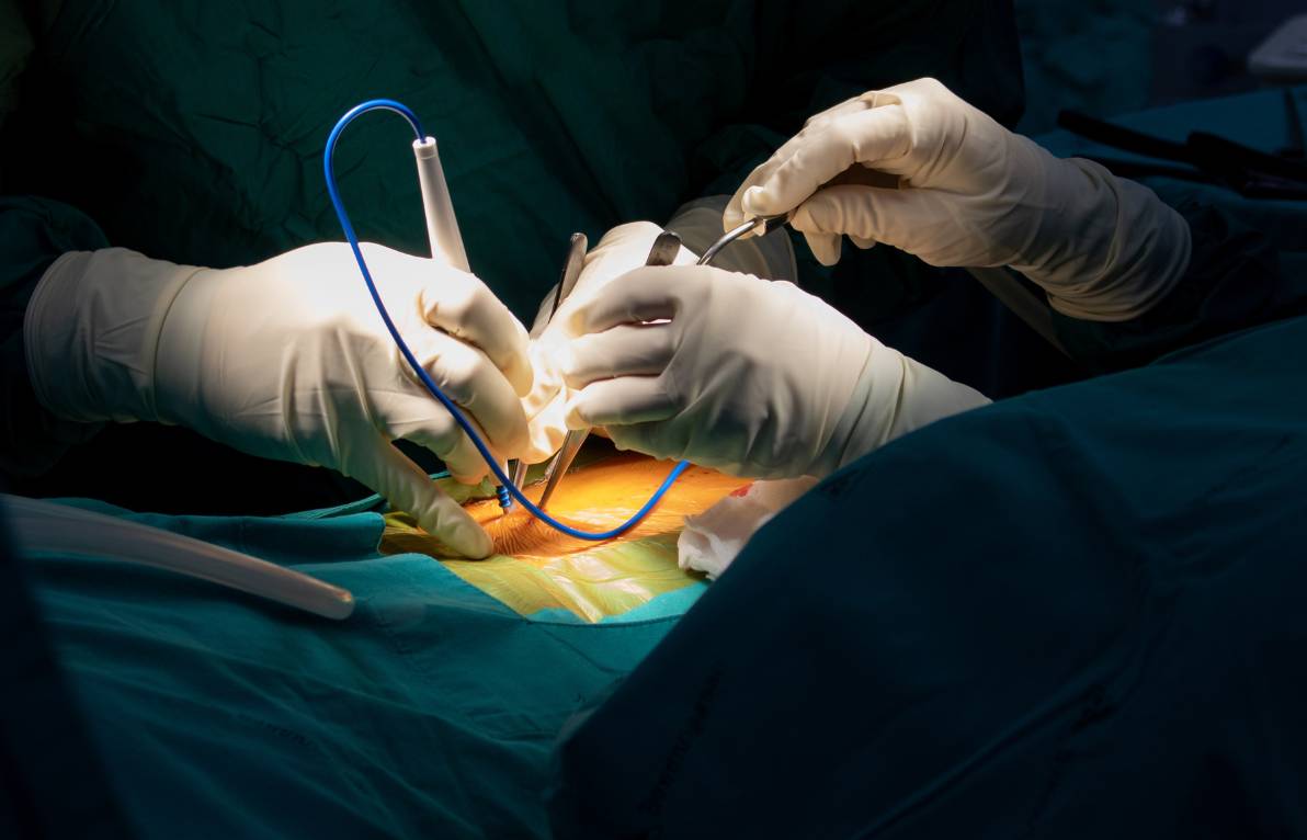 Advanced Spine Surgery Techniques at Apollo Hospitals: Minimally Invasive Options and Cutting-Edge Technology