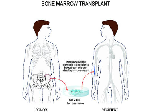 Stem Cell