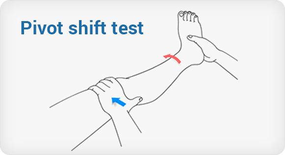 Pivot Shift Test demonstration