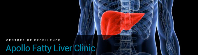 Best Fatty Liver Hospital in India