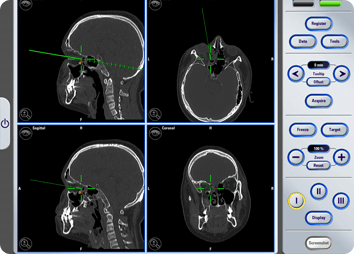 Navigation Technology for Maxillofacial Surgery