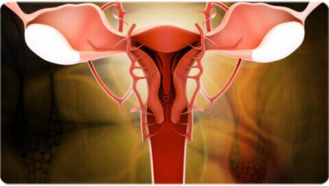 Ovarian cancer