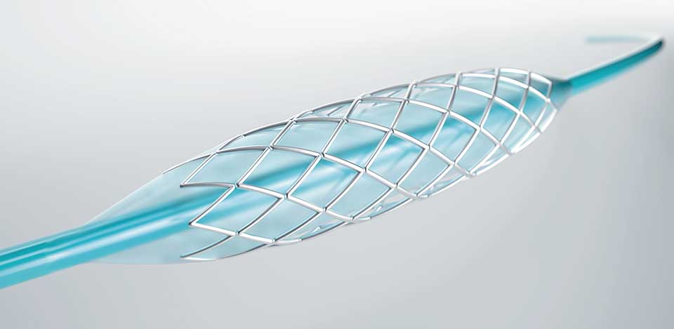 Our Stents Pricing