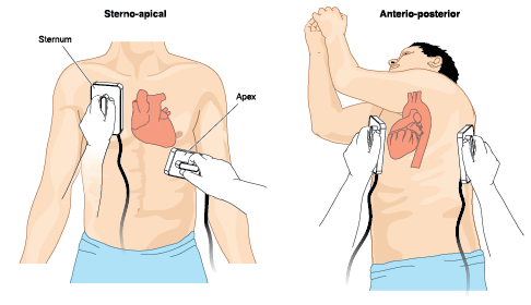 Emergency Care in Cardiac Disease