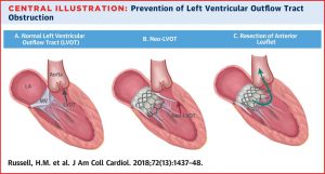 Mitral Valve replacements