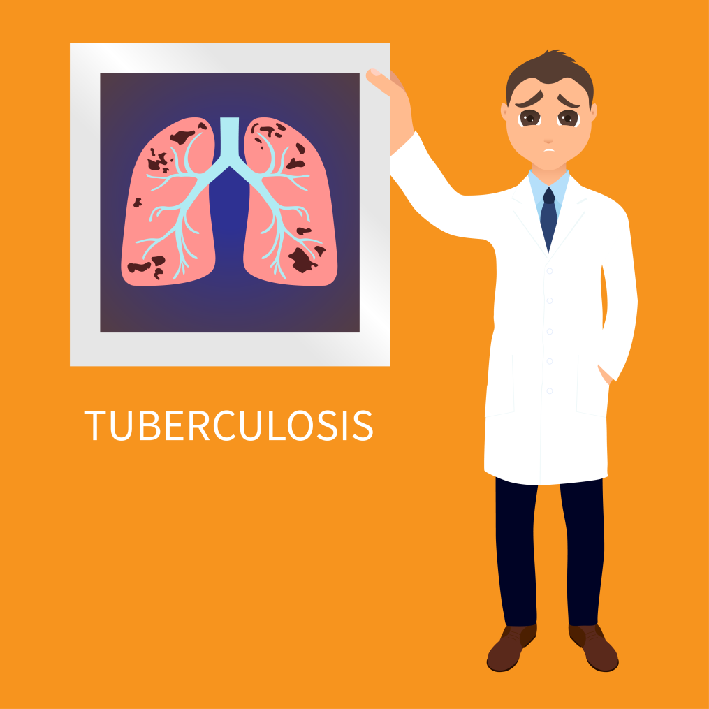 Complete Guide to Tuberculosis Causes, Symptoms & Treatment