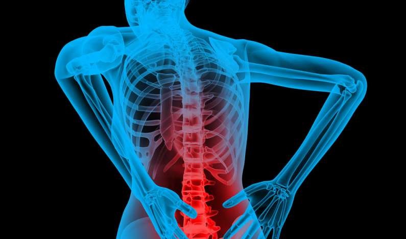 Back Pain (Lower and Upper) : Symptoms, Causes, Treatment, Diagnosis and Prevention