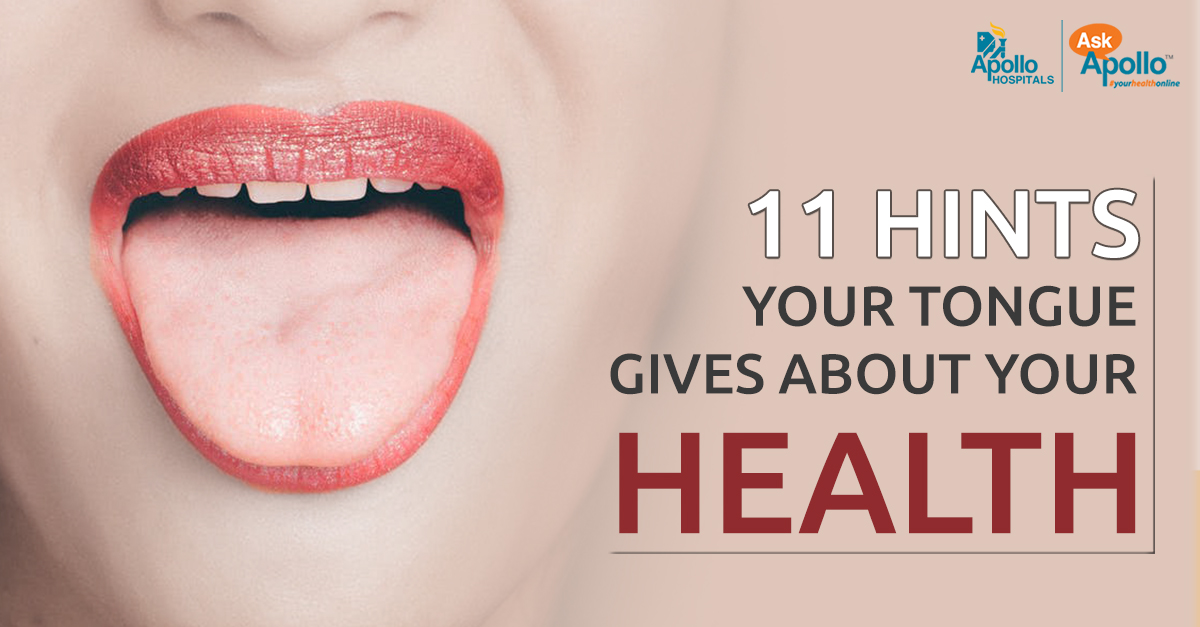 Eleven Hints Your Tongue Gives about Your Health