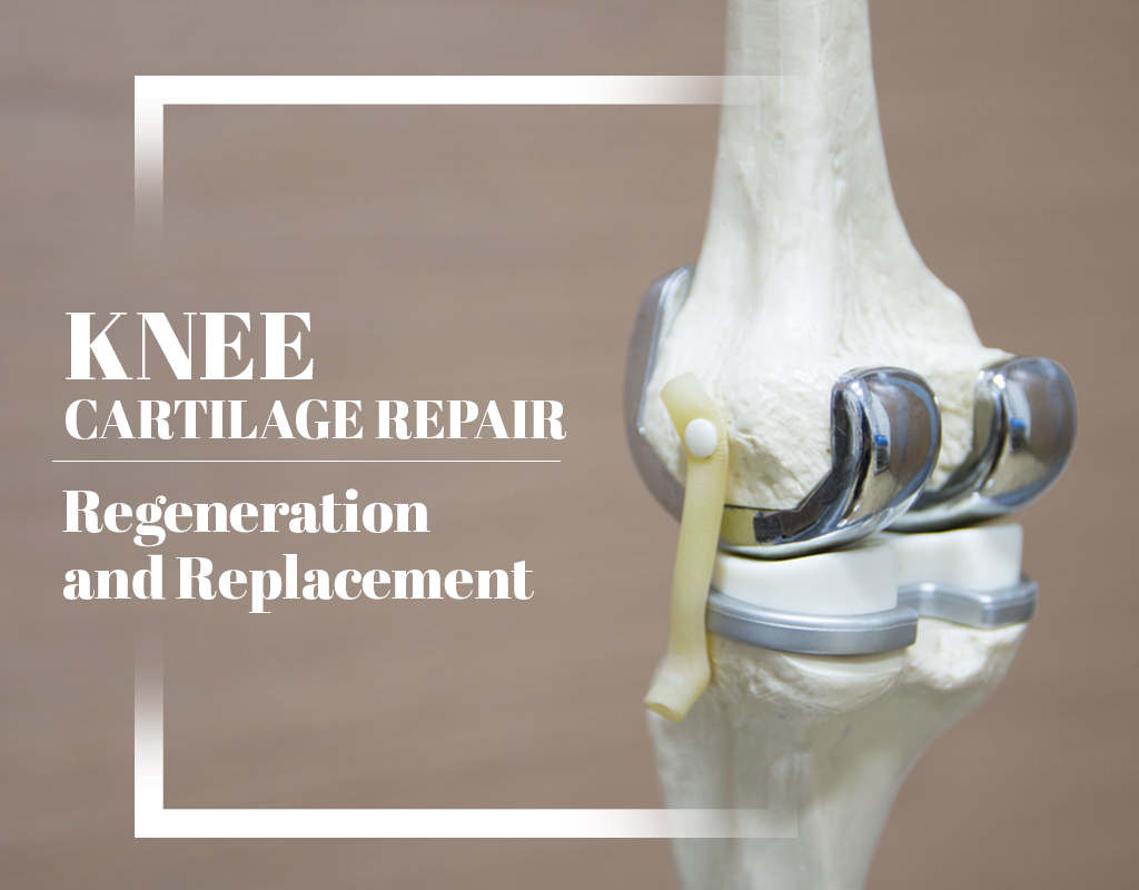 Knee Cartilage Injury