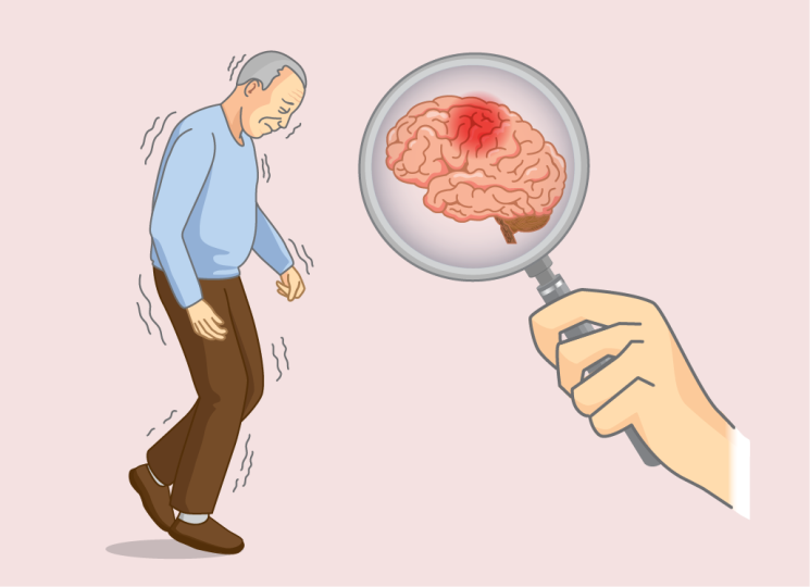 All You Wanted to Know About Alzheimer’s Disease