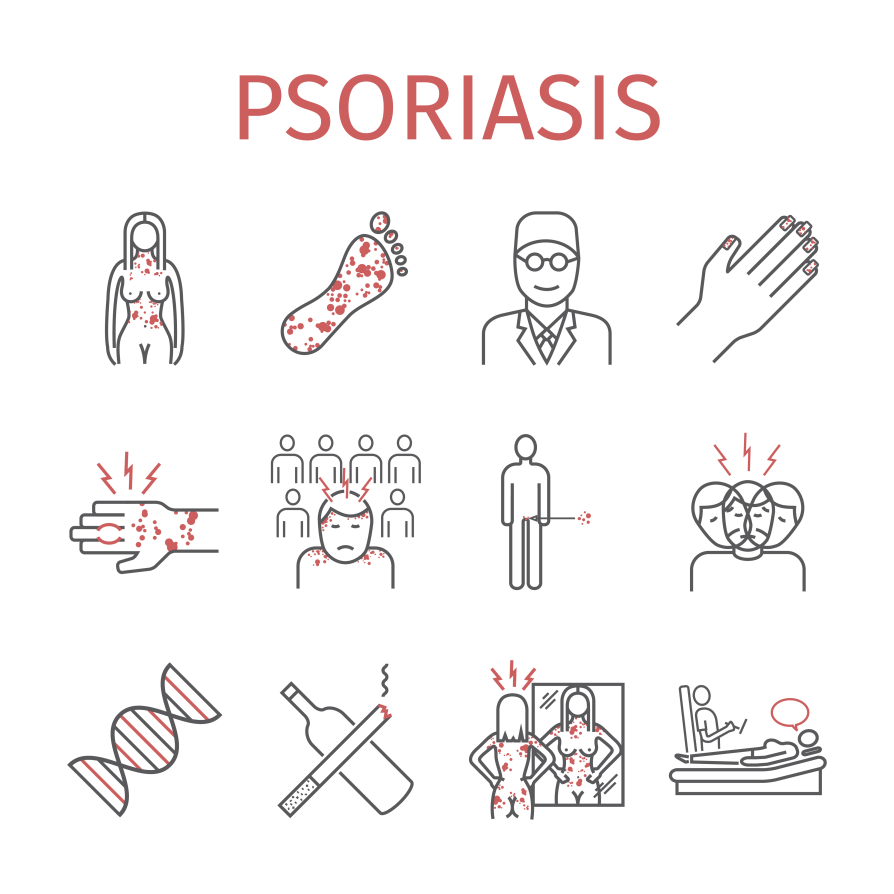 Psoriasis – Types, Symptoms, Causes and Treatment