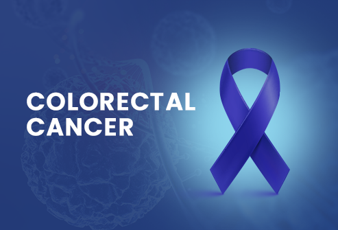 Colorectal cancer