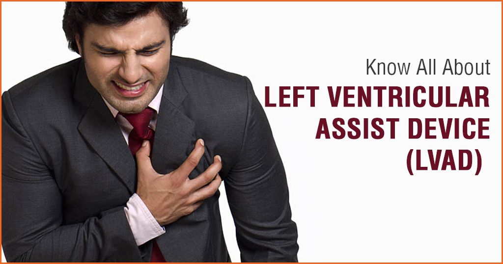 Left Ventricular Assist Device (lvad)   – All you wanted to know