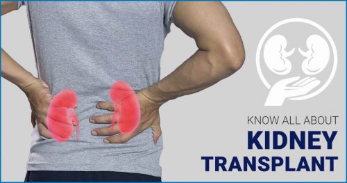 Kidney Transplant – What to Expect, Procedure and Types