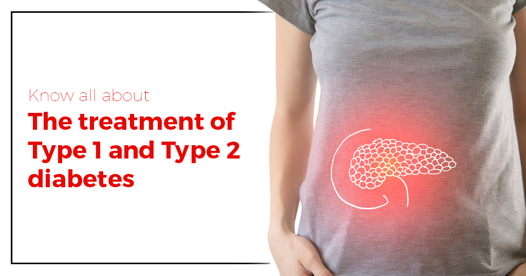 Pancreas Transplantation for Type 1 and Type 2 Diabetes