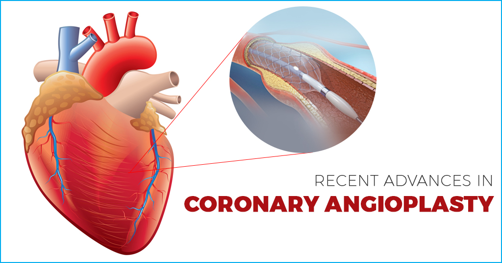 Recent Advances in Coronary Angioplasty