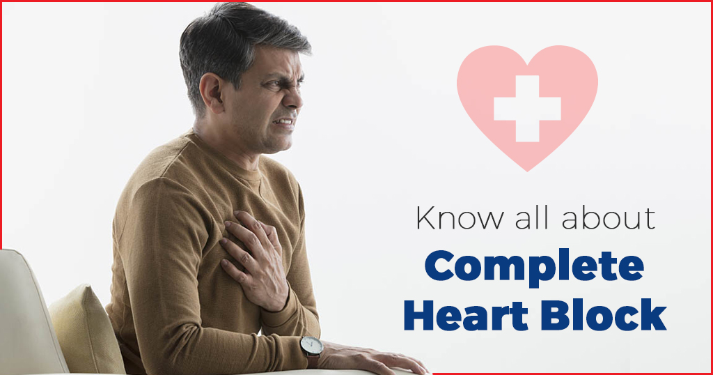 Complete Heart Block (Third-degree Atrioventricular (AV) Block)