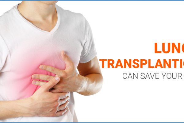 Lung Transplantation – All you wanted to know