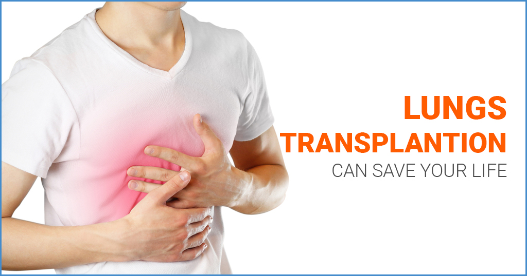 Lung Transplantation – All you wanted to know