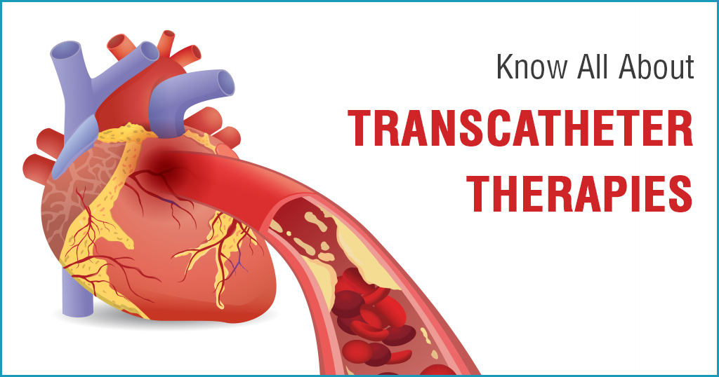 Transcatheter Therapies – Adding Years to Life and Life to Years