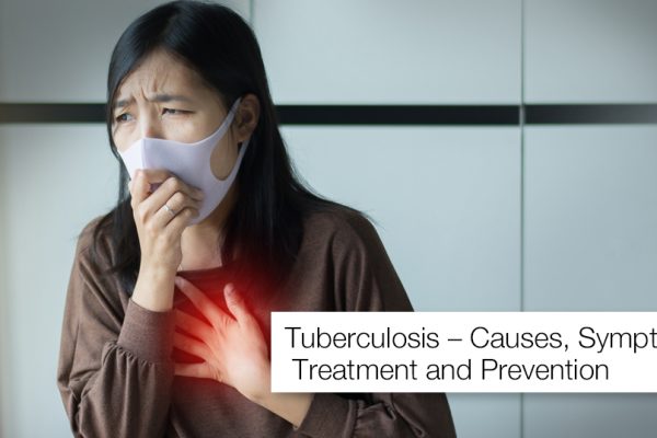 Tuberculosis – All you need to know