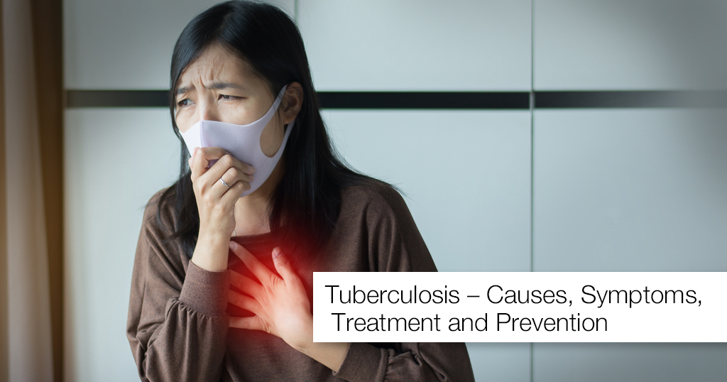 Tuberculosis – All you need to know