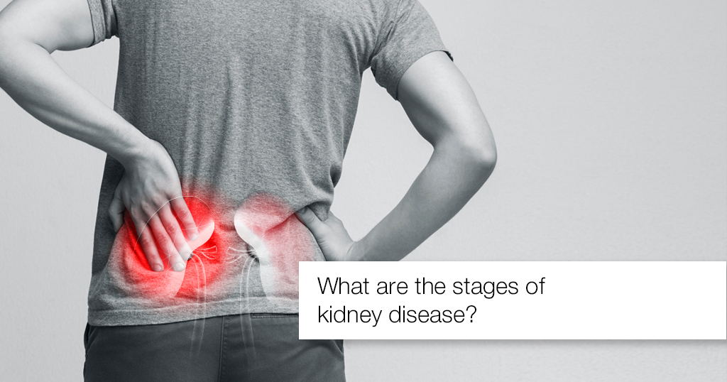 What are the stages of kidney disease?