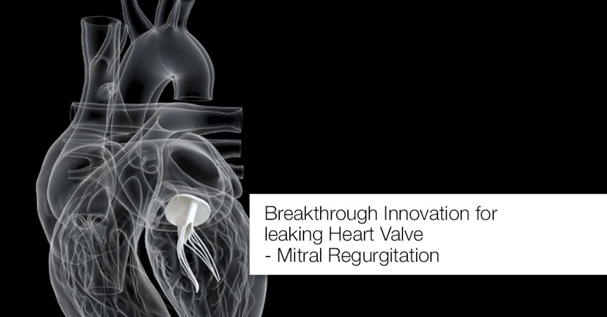 BREAKTHROUGH INNOVATION FOR LEAKING HEART VALVE – MITRAL REGURGITATION