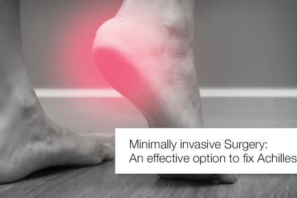 Minimally Invasive Surgery An Effective Option To Fix Achilles Tear