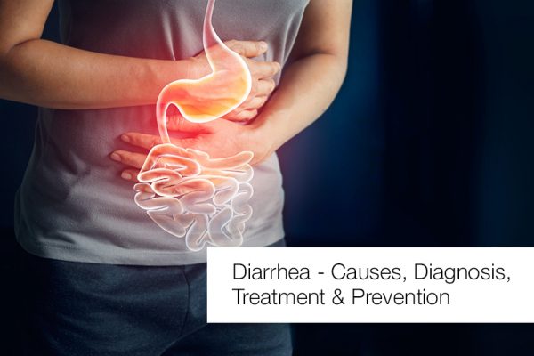 Diarrhea – Causes, Diagnosis, Treatment and Prevention