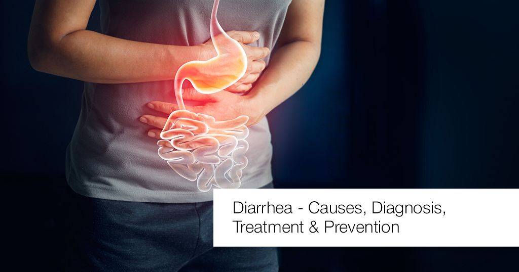 Diarrhea – Causes, Diagnosis, Treatment and Prevention