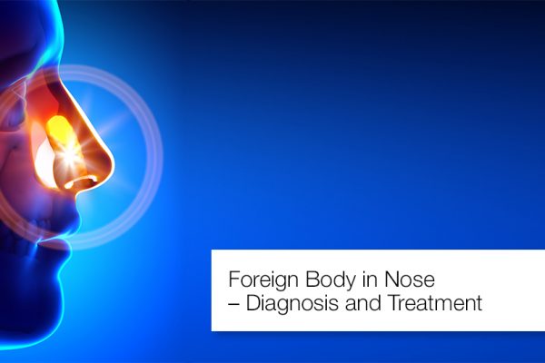 Foreign Body In Nose – Diagnosis And Treatment