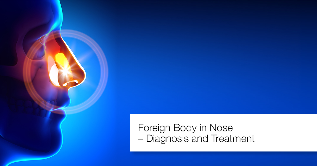 Foreign Body In Nose – Diagnosis And Treatment