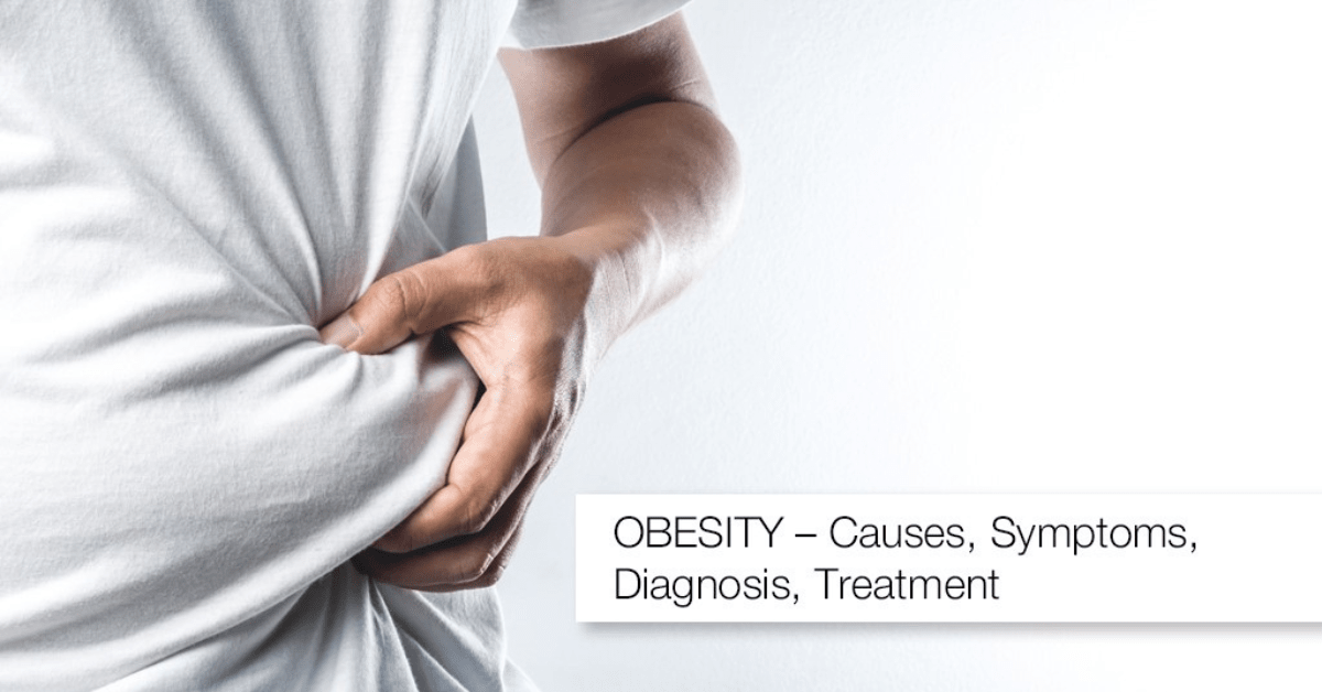 OBESITY – Causes, Symptoms, Diagnosis, Treatment