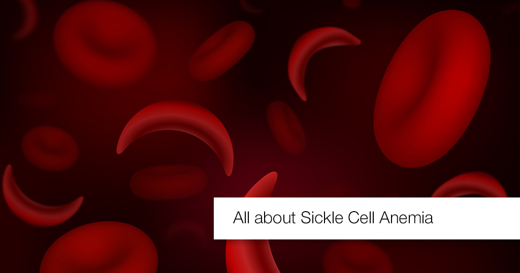 All about Sickle Cell Anemia