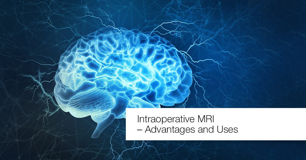 Intraoperative MRI – Advantages and Uses – Apollo Hospitals Blog