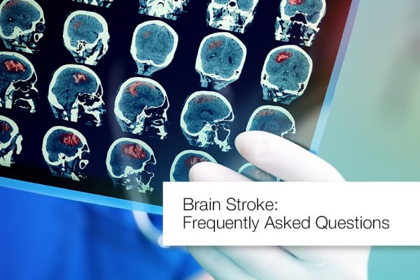 Brain Stroke – Symptoms, Risk Factors and Treatment