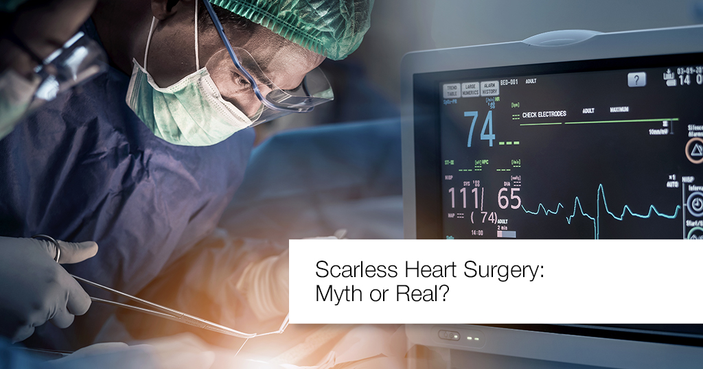 SCARLESS HEART SURGERY — MYTH OR REAL