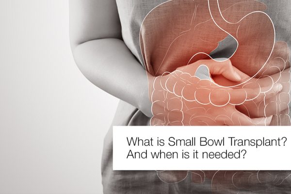 What is Small bowel transplant? When a small bowel transplant is needed?