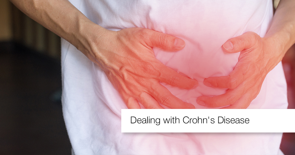 Dealing with Crohn’s Disease