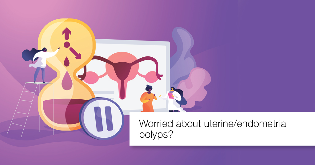 Worried about uterine/endometrial polyps?