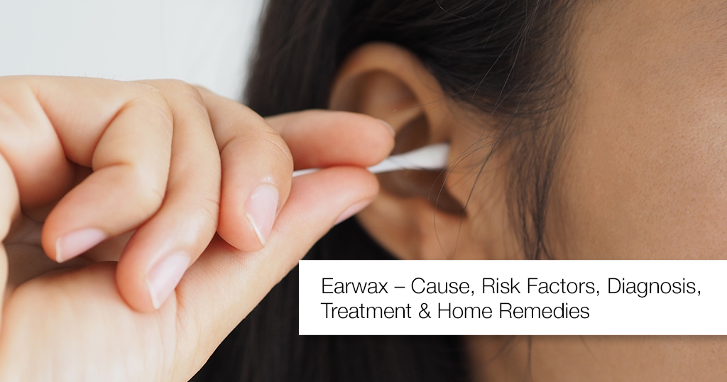 EARWAX – CAUSES, RISK FACTORS, DIAGNOSIS, TREATMENT AND HOME REMEDIES