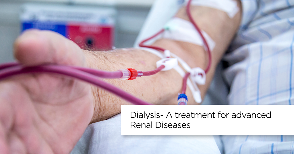 Dialysis | Kidney Failure Symptoms | Renal Disease